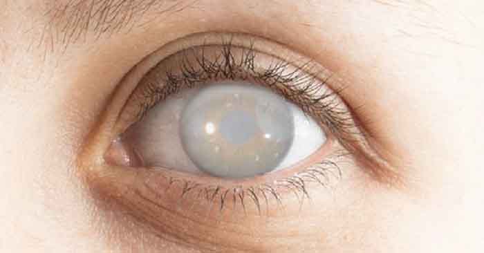 SESA se adhiere a la conmemoración del Día Mundial del Glaucoma
