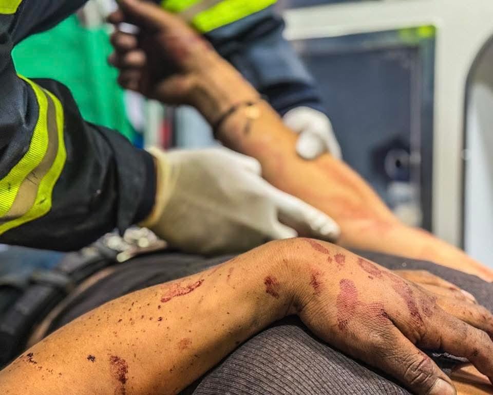 FUERTE CHOQUE ENTRE DOS PLATAFORMAS EN CARRETERA SAN JUAN DEL RÍO-XILITLA DEJA UN HERIDO