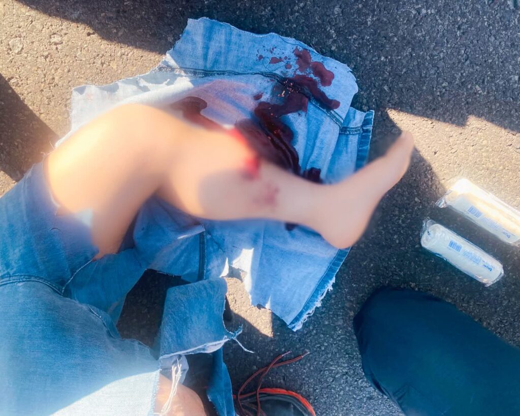 Atropellamiento en Bernardo Quintana deja una persona lesionada