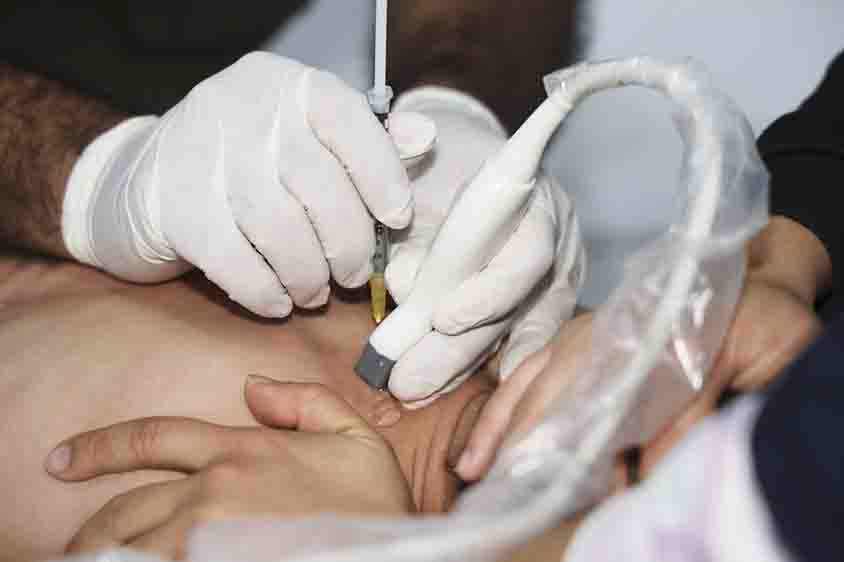 Realizó DIF Jornada de Toxina Botulínica para personas con discapacidad