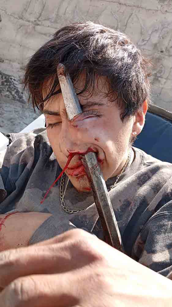 Empalado de la cara 1