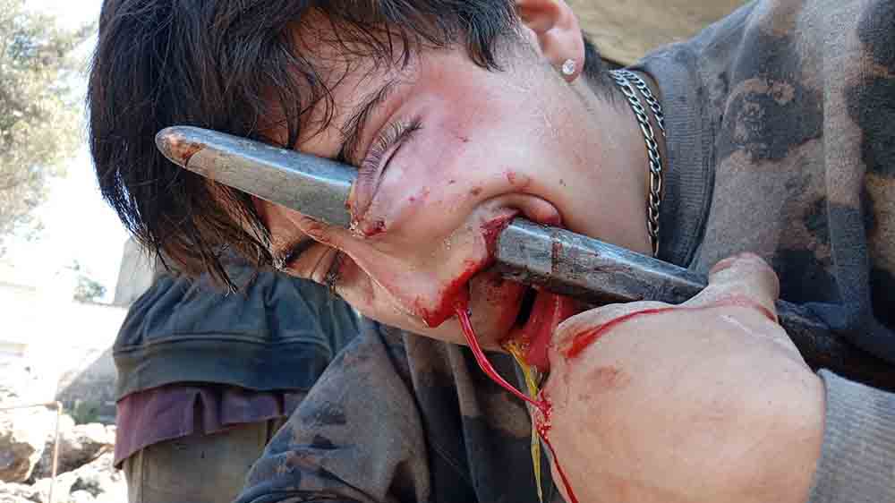 Empalado de la cara 1